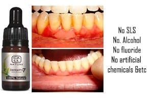 Healthy Gums Vs Unhealthy Gums - Unhealthy Gums Applying Dental Pro 7