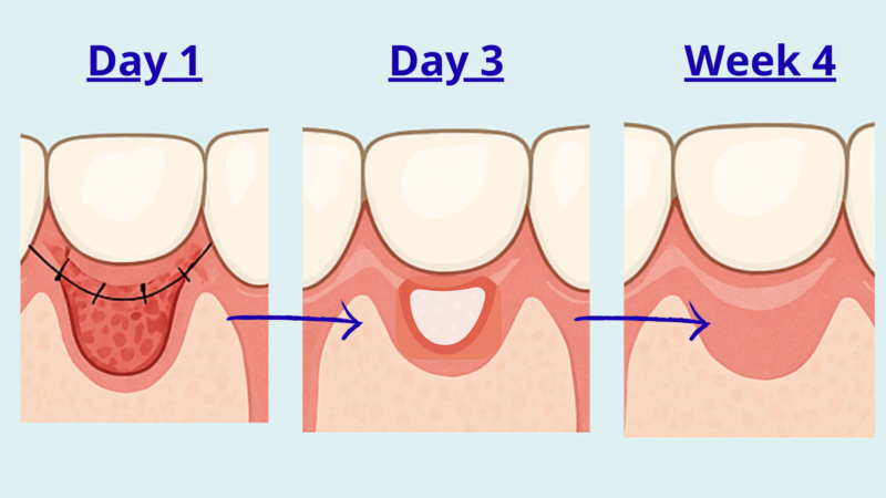 strengthen weak gums naturally