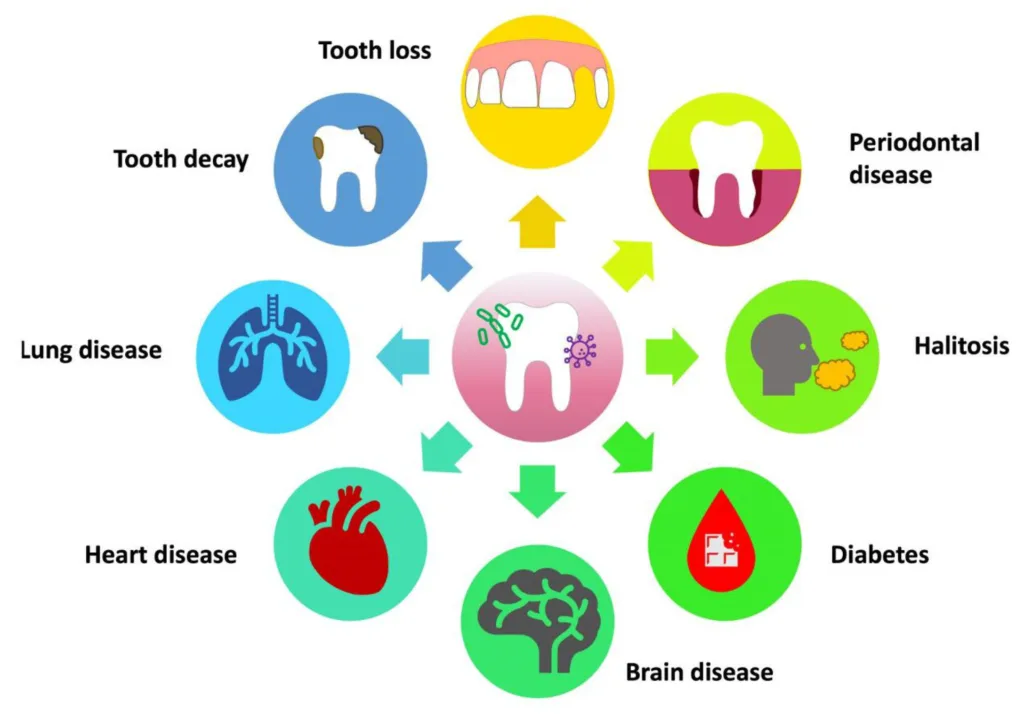 benefits of dental pro