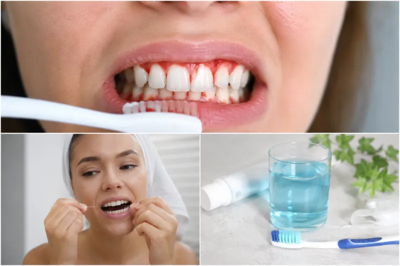 Bleeding gums treatment guide