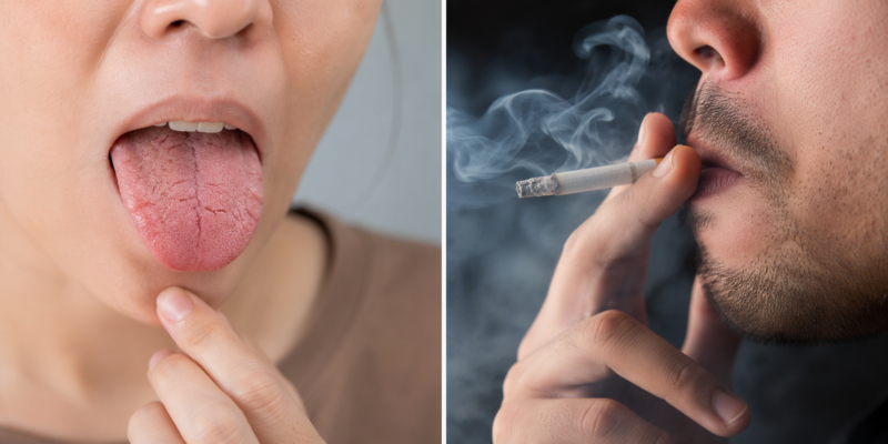 Common Factors That Disrupt the Balance of Oral Bacteria
